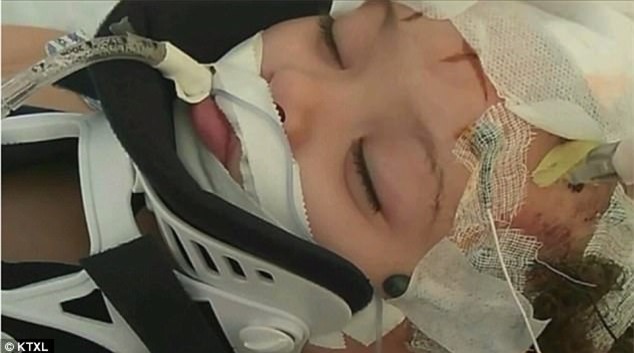 Bé gái 2 tuổi tổn thương não vì bị bảo mẫu là một cậu thiếu niên 16 tuổi trừng phạt - Ảnh 1.