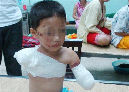 cau chuyen thuong tam ve tai nan cua tre khien ai biet cung am anh - 3