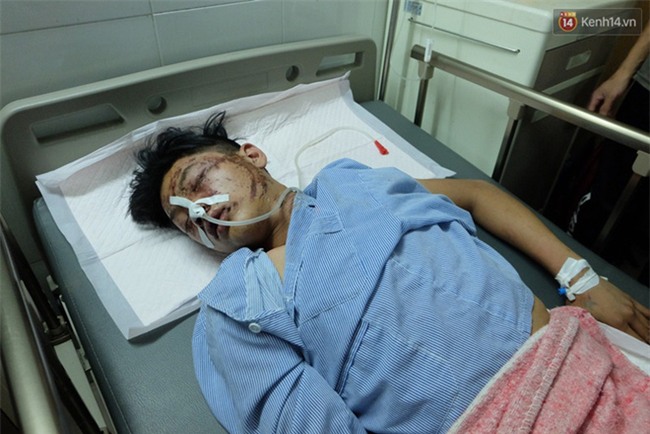 Người thân không nhận ra nam sinh mắc kẹt dưới gầm ô tô Camry sau tai nạn kinh hoàng ở Bắc Ninh - Ảnh 5.