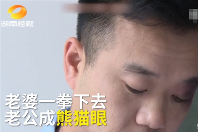 Vợ đánh chồng thâm mắt, nhưng sau đó phải xấu hổ xin lỗi khi biết nguyên nhân cao cả phía sau - Ảnh 3.