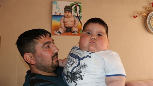 cuoc song cua be 18 thang nang 32 kg tieu ton 1 ty dong tien thuoc moi thang - 2