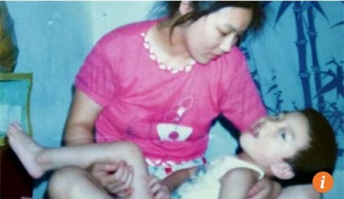 Harvard, trẻ khuyết tật, bại não