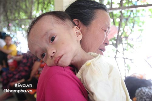 xot xa hinh anh em be sinh ra nang 4kg, sau mot nam chi con 3,4kg - 5
