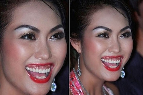 cuoi ho loi, phi thanh van dau don "dap di xay lai" 6 lan moi co ket qua - 2