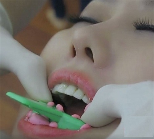 cuoi ho loi, phi thanh van dau don "dap di xay lai" 6 lan moi co ket qua - 4