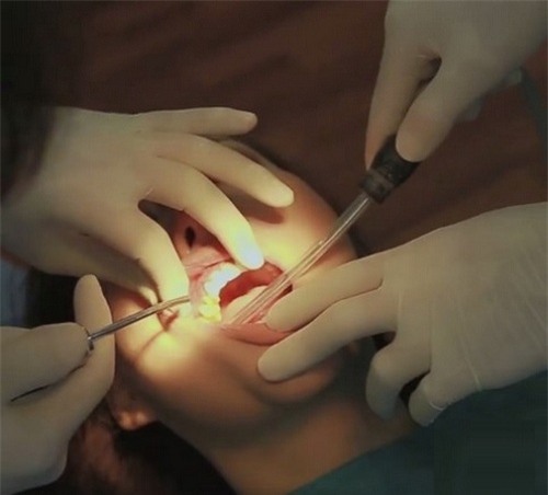 cuoi ho loi, phi thanh van dau don "dap di xay lai" 6 lan moi co ket qua - 5