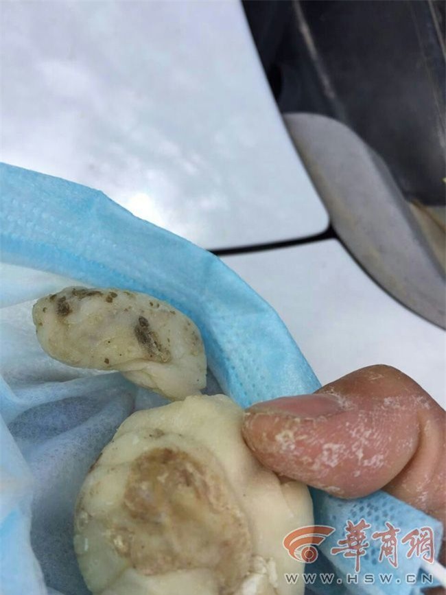 Trường mầm non nấu trứng thối, hạt đậu mốc, gia vị hỏng cho học sinh ăn gây bức xúc - Ảnh 1.