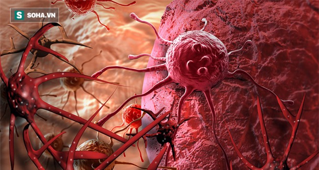 Bác sĩ bệnh viện Việt Đức khuyên 6 điều nên làm ngay để bệnh ung thư không gõ cửa - Ảnh 1.