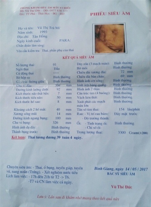 thuc hu ba bau nguy kich, thai chet luu sau 10 phut vao phong mo vi me an qua no - 3