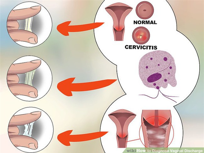 Những dấu hiệu để nhận biết khí hư bình thường và bất thường mà bạn cần lưu ý - Ảnh 1.