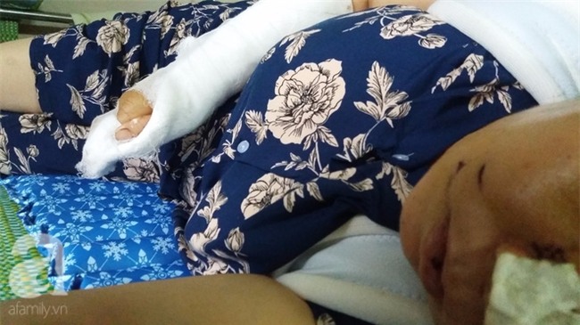 Nỗi đau của người vợ thoát chết sau khi bị chồng tra tấn như thời trung cổ ở Ninh Bình - Ảnh 2.