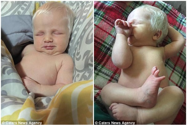 Em bé vừa chào đời đã có mái tóc bạc trắng như tuyết, làm náo loạn mạng xã hội - Ảnh 2.