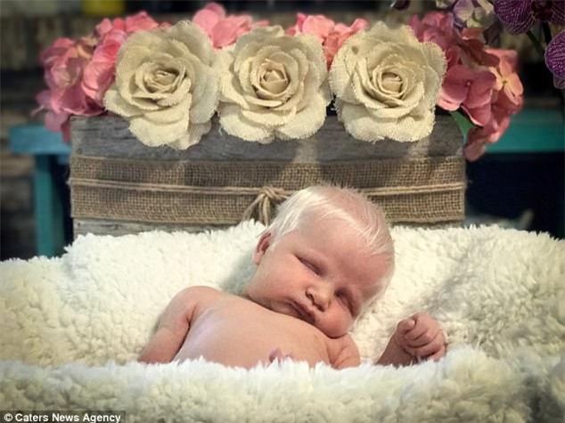 Em bé vừa chào đời đã có mái tóc bạc trắng như tuyết, làm náo loạn mạng xã hội - Ảnh 6.