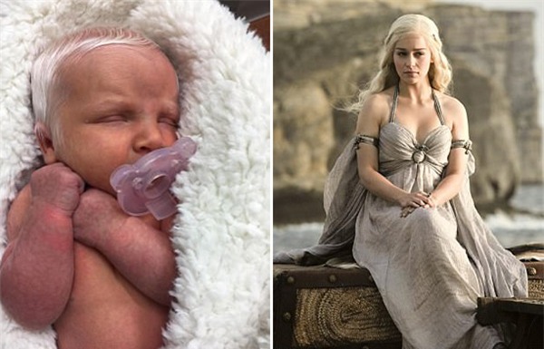 Em bé vừa chào đời đã có mái tóc bạc trắng như tuyết, làm náo loạn mạng xã hội - Ảnh 7.