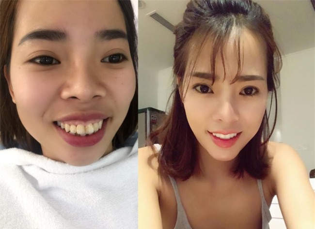 Co gai chi 200 trieu 'dao keo' khien nguoi than khong nhan ra hinh anh 1