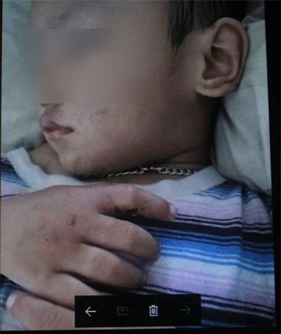 nghi an be trai 2 tuoi bi ban trai cua me danh dap hinh anh 1