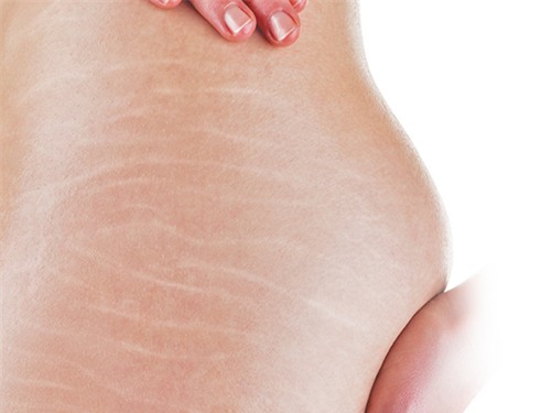 ran da lau nam den may cung se mo dan voi 2 cong thuc don gian tu vien vitamin e - 1