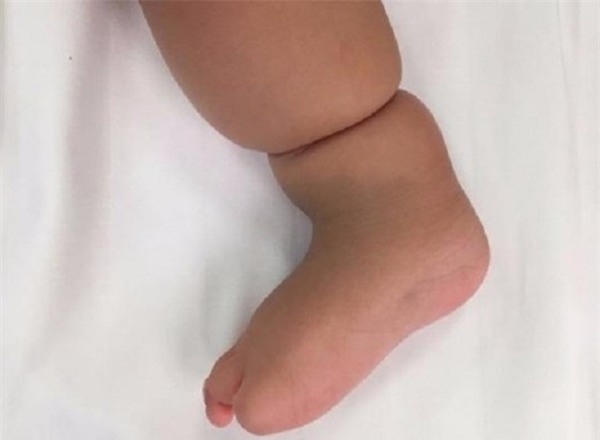 tay chan be co ngan tuong bu bam, hoa ra benh la - 1