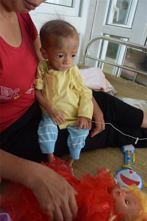 nuoc mat nguoi me co con mac benh ngay cang teo det, 4 tuoi nang 3.6kg - 3