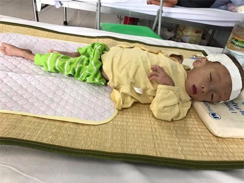 nuoc mat nguoi me co con mac benh ngay cang teo det, 4 tuoi nang 3.6kg - 5