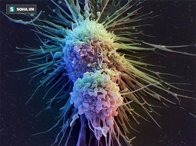 Sự thật về những thực phẩm gây ung thư kinh hoàng: Ai cũng nên biết để ăn cho đúng - Ảnh 1.