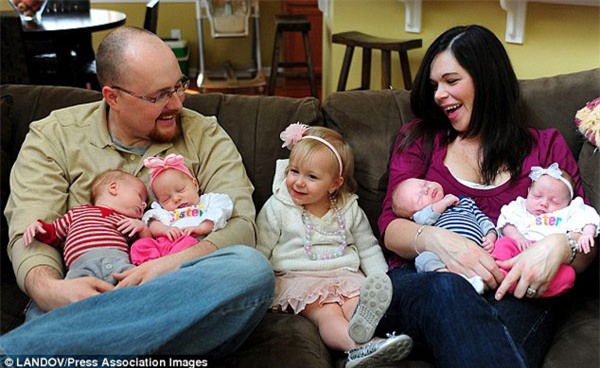 chi chuyen 2 phoi thai, me "soc nang" khi nhin man hinh sieu am ra 4 em be - 1