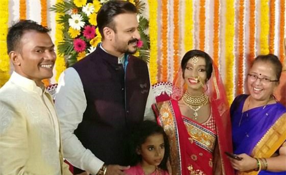 Co gai bi tat axit vao mat lay duoc chong nho goi nham so hinh anh 3