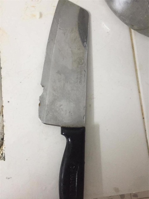 vo noi con dien cam dao doa "xien chet" khien chong vu phu mat cat khong mot giot mau - 1