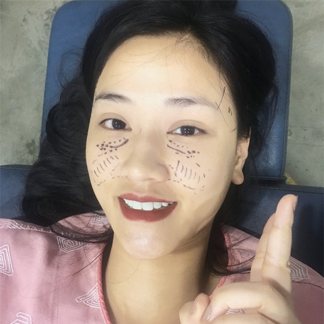 Maya tự tin khoe ảnh khuôn mặt vừa phẫu thuật thẩm mỹ tại Hàn Quốc - Ảnh 3.