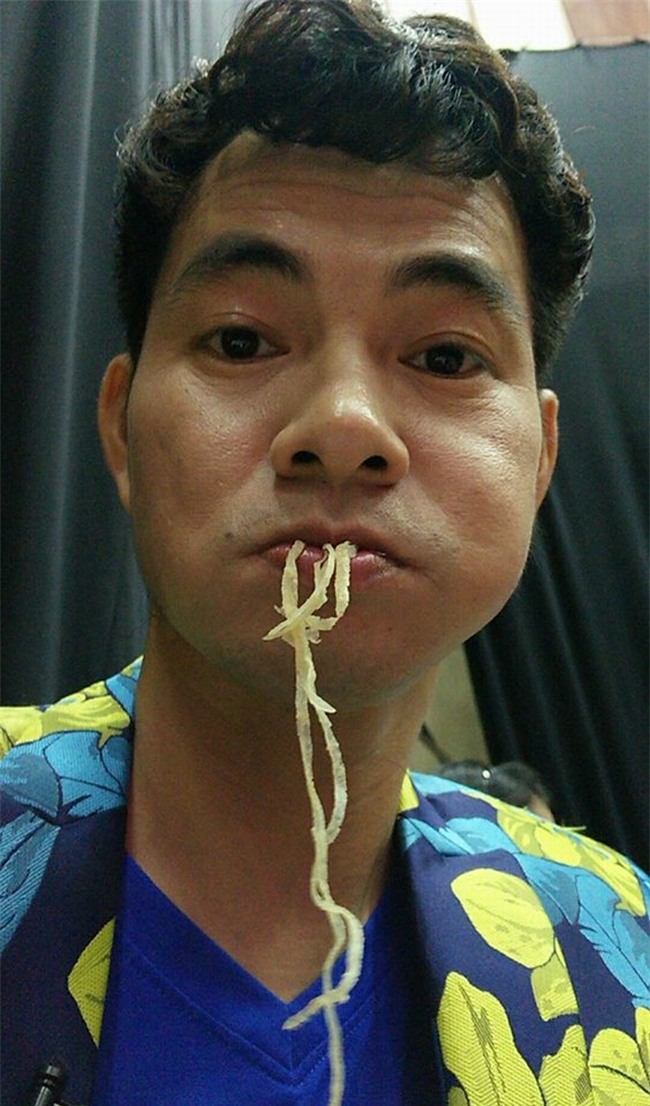 mat trai sau su noi tieng va "chay so" trien mien cua danh hai xuan bac hinh anh 15