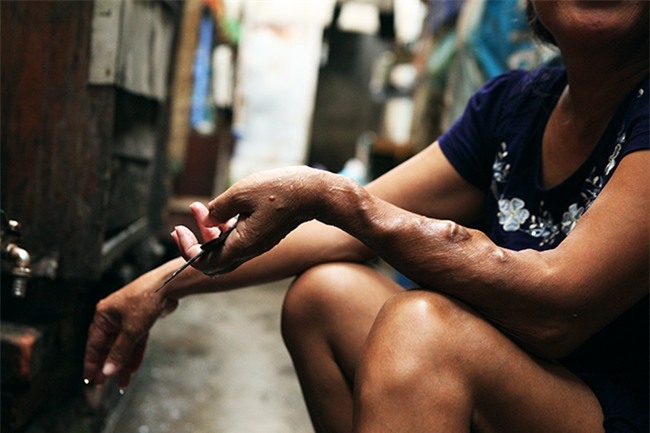 Những mảnh đời ở "xóm chạy thận" giữa lòng Hà Nội - 2