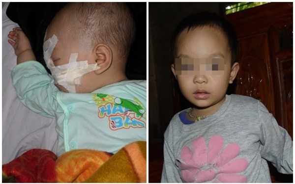 Gặp lại cô bé mới 6 tháng tuổi đã bị kẻ ác chém trọng thương bên thi thể người mẹ - Ảnh 2.