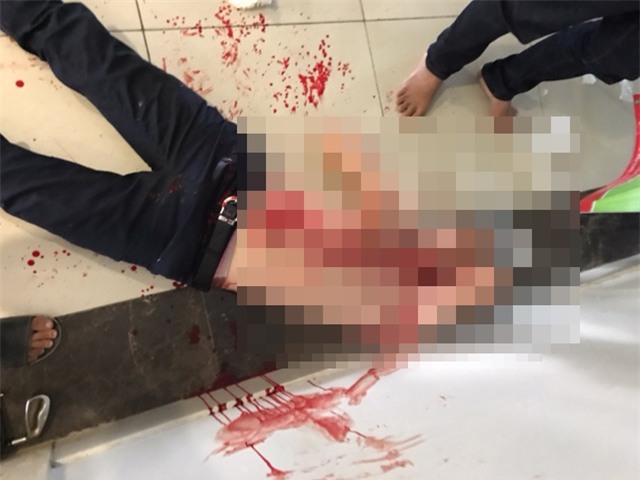 Anh T bị chém nhiều nhát vào người trong tại sân tòa nhà chung cư Mandarin Garden