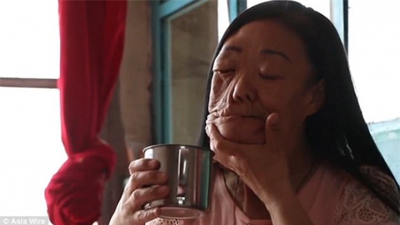 chuyện lạ,chuyện lạ 4 phương,Liu Ying,căn bệnh kỳ lạ,mạng xã hội