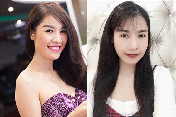 Sao Việt đang có xu hướng công khai quá trình phẫu thuật thẩm mỹ trên mạng xã hội - Ảnh 14.