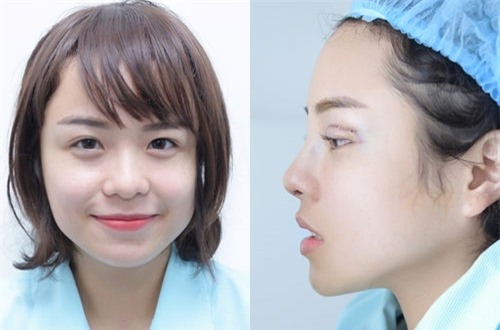 Sao Việt đang có xu hướng công khai quá trình phẫu thuật thẩm mỹ trên mạng xã hội - Ảnh 17.