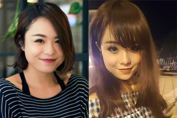 Sao Việt đang có xu hướng công khai quá trình phẫu thuật thẩm mỹ trên mạng xã hội - Ảnh 24.