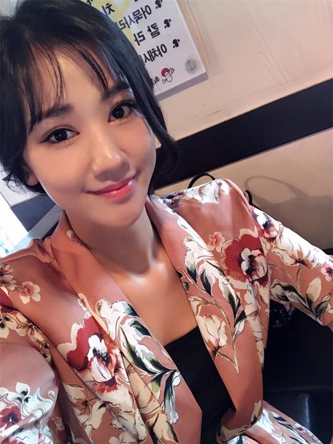 Sao Việt đang có xu hướng công khai quá trình phẫu thuật thẩm mỹ trên mạng xã hội - Ảnh 5.