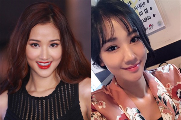 Sao Việt đang có xu hướng công khai quá trình phẫu thuật thẩm mỹ trên mạng xã hội - Ảnh 6.