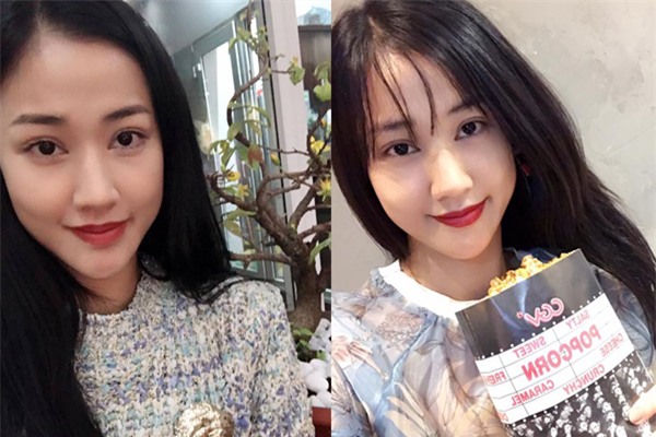 Sao Việt đang có xu hướng công khai quá trình phẫu thuật thẩm mỹ trên mạng xã hội - Ảnh 7.