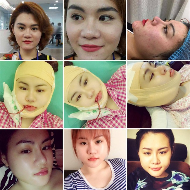 15 tuổi bắt đầu thẩm mỹ và chi trả hết 900 triệu, cô gái Bến Tre đang gây nhiều tranh cãi - Ảnh 4.