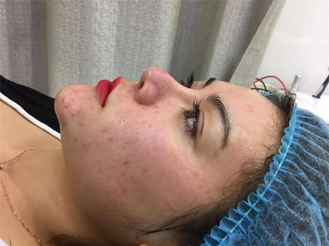 15 tuổi bắt đầu thẩm mỹ và chi trả hết 900 triệu, cô gái Bến Tre đang gây nhiều tranh cãi - Ảnh 6.