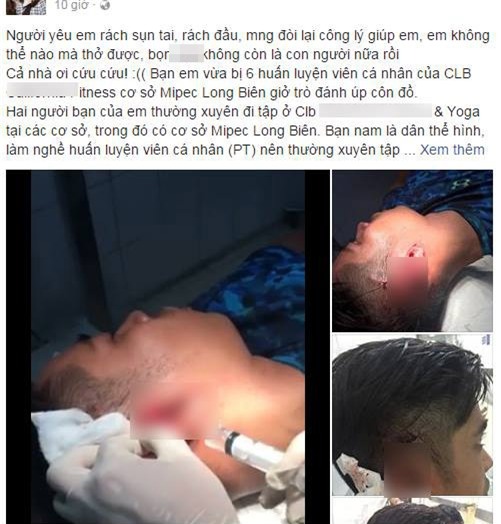 Hà Nội: Thanh niên tố bị nhiều huấn luyện viên Yoga đánh gẫy tai vì đi theo bạn gái vào phòng tập - Ảnh 1.