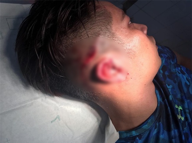 Hà Nội: Thanh niên tố bị nhiều huấn luyện viên Yoga đánh gẫy tai vì đi theo bạn gái vào phòng tập - Ảnh 2.