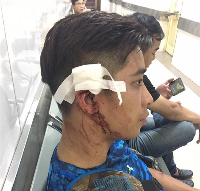 Hà Nội: Thanh niên tố bị nhiều huấn luyện viên Yoga đánh gẫy tai vì đi theo bạn gái vào phòng tập - Ảnh 3.