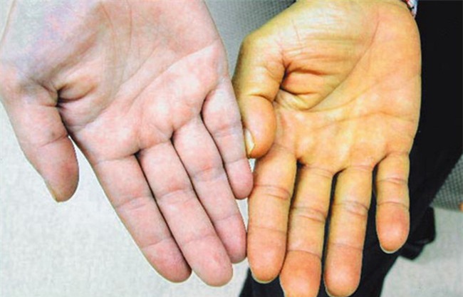 Uống 1 cốc nước mía kèm lát chanh tươi: Cách phòng trừ bệnh rất hiệu quả của người Ấn Độ - Ảnh 2.