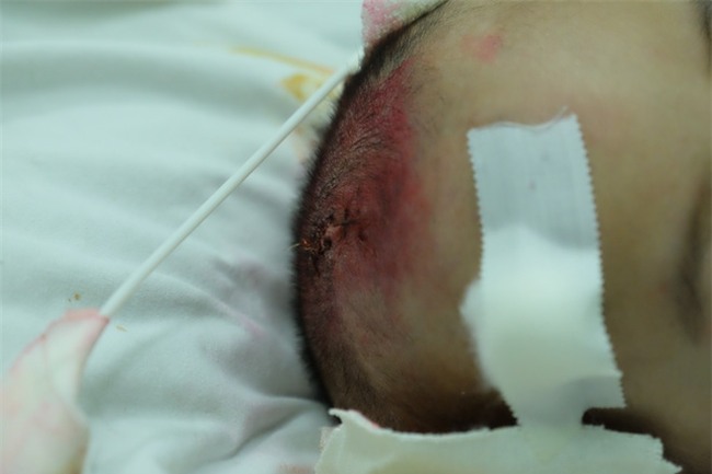 Chồng bặt vô âm tích, mẹ trẻ đau khổ 9 tháng trời một mình nuôi con bạo bệnh - Ảnh 12.