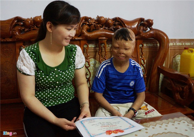 Cuoc song cua cau be bi cha tam xang dot 6 nam truoc hinh anh 11