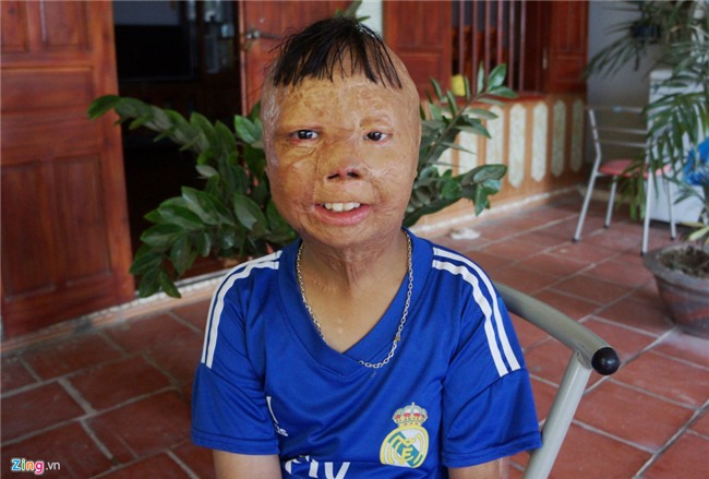 Cuoc song cua cau be bi cha tam xang dot 6 nam truoc hinh anh 1