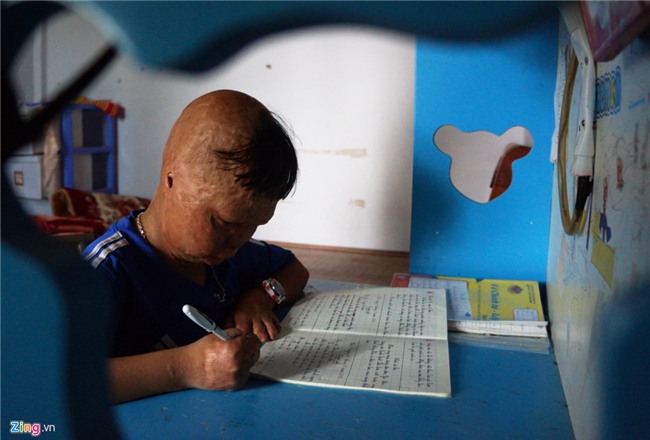 Cuoc song cua cau be bi cha tam xang dot 6 nam truoc hinh anh 4